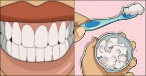 Simplest Way to Whiten the Teeth
