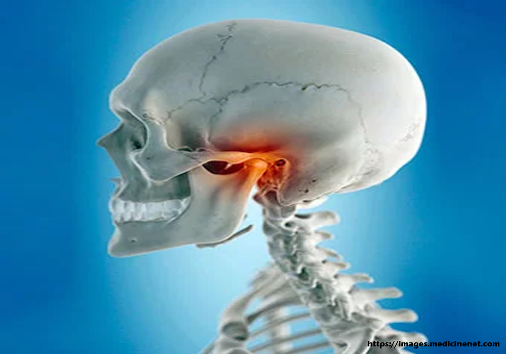 How To Temporarily Treat TMJ Syndrome In The Absence Of A Physician